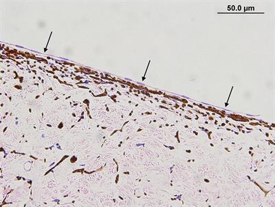 Prevalence of pre-iridal monocellular and fibrovascular membranes in canine globes affected with congenital glaucoma associated with anterior segment dysgenesis, primary glaucoma associated with goniodysgenesis, and secondary glaucoma